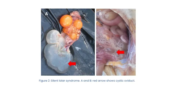 Revisiting infectious bronchitis Variant 2 in layer hens | Phibro